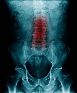Spinal X Ray